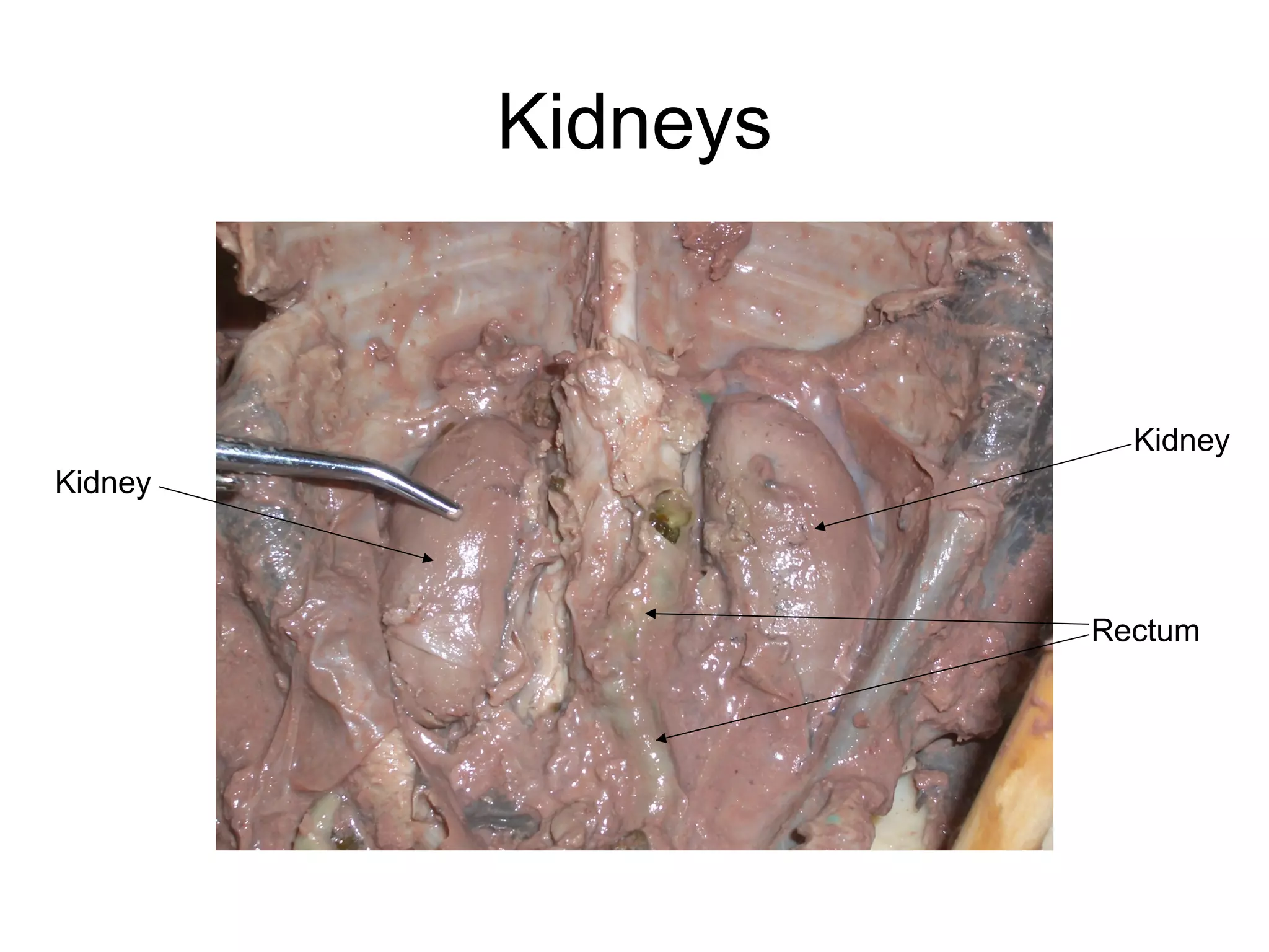 Kidneys
Kidney
Kidney
Rectum
 