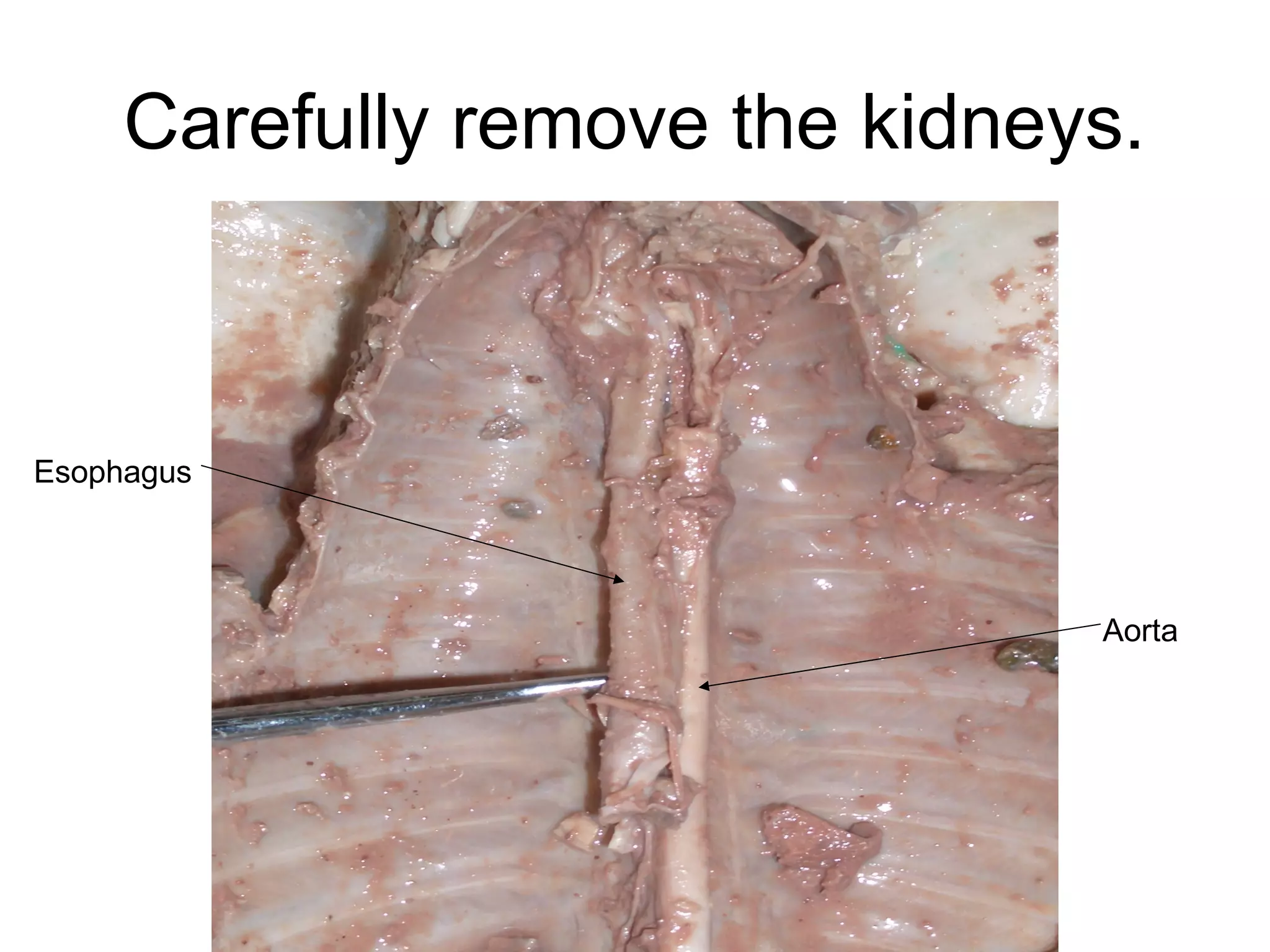 Carefully remove the kidneys.
Esophagus
Aorta
 