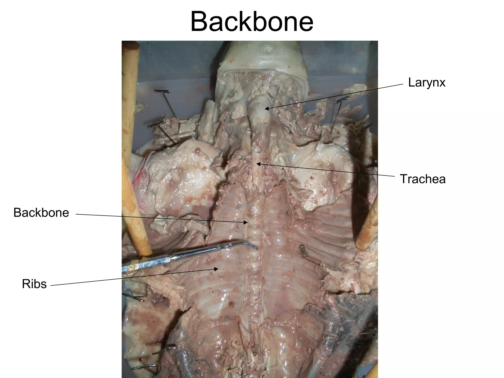 Backbone
Backbone
Larynx
Trachea
Ribs
 