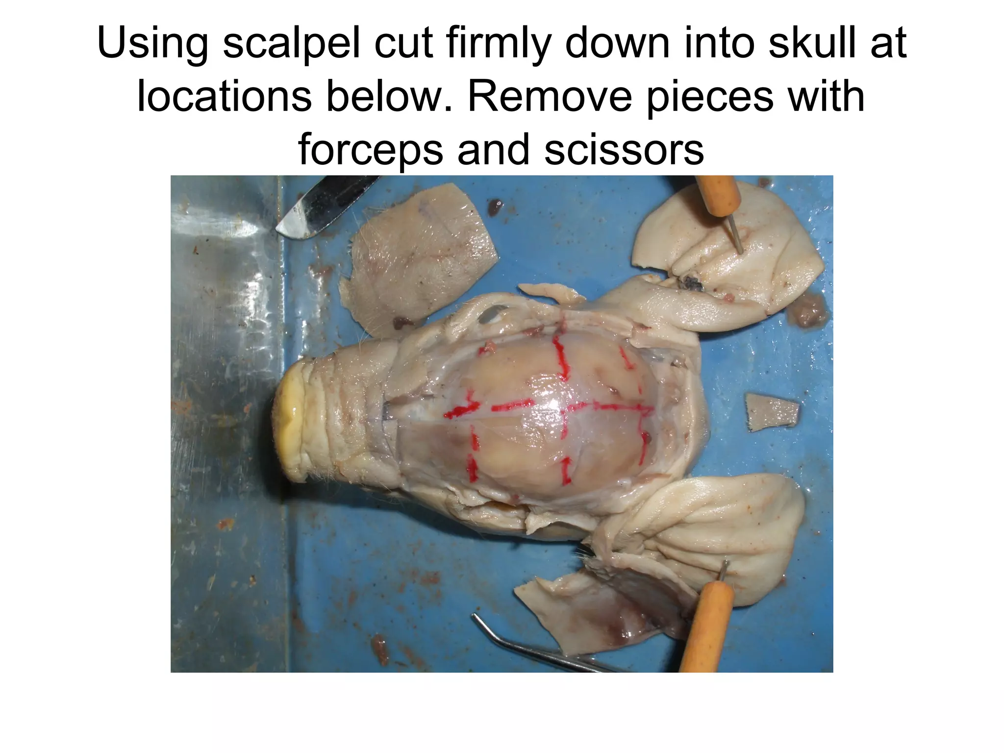 Using scalpel cut firmly down into skull at
locations below. Remove pieces with
forceps and scissors
 