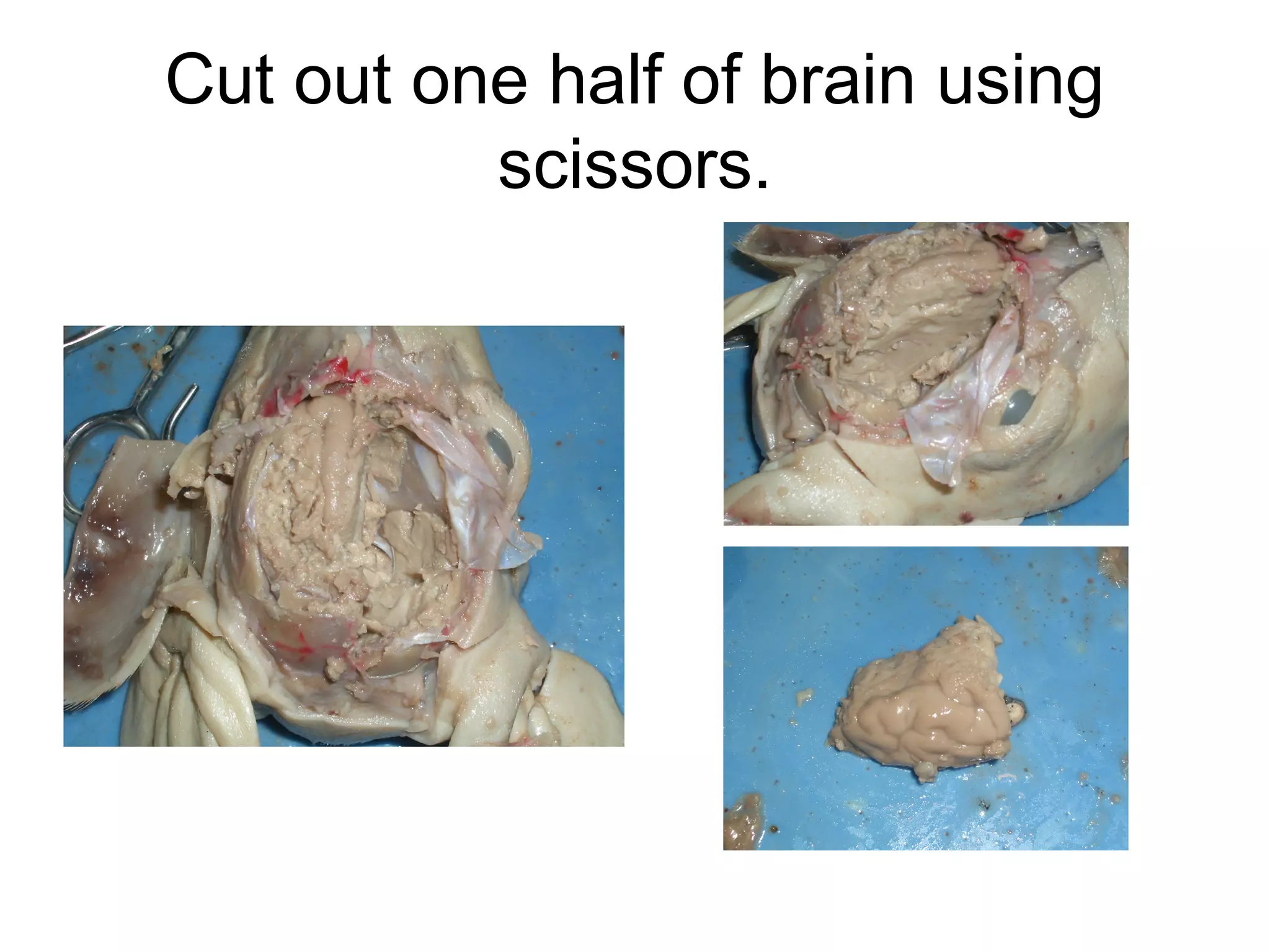 Cut out one half of brain using
scissors.
 