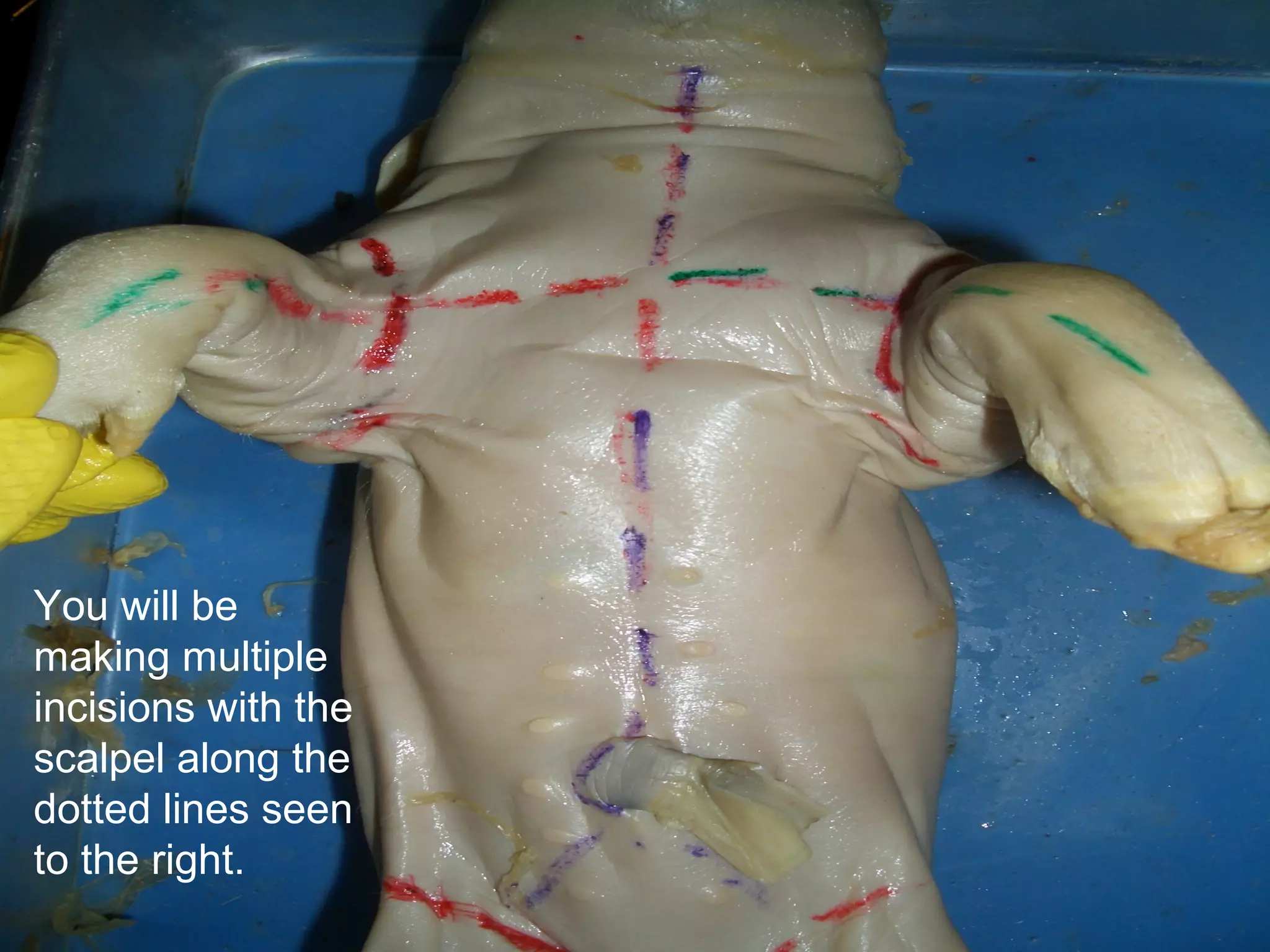 You will be
making multiple
incisions with the
scalpel along the
dotted lines seen
to the right.
 