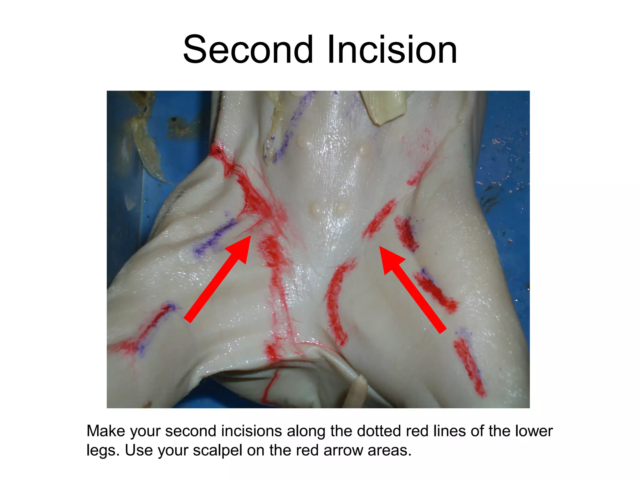 Second Incision
Make your second incisions along the dotted red lines of the lower
legs. Use your scalpel on the red arrow areas.
 