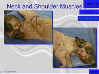 Contents
Neck and Shoulder Muscles 3
Back to Muscle index
Answers
 