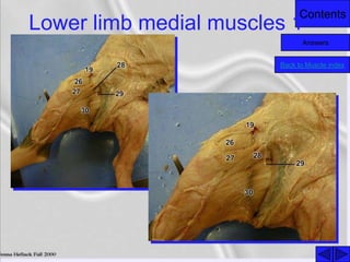 Contents
Lower limb medial muscles 1
Back to Muscle index
Answers
 