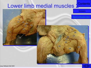 Contents
Lower limb medial muscles 2
Back to Muscle index
Answers
 
