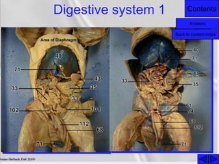 ContentsDigestive system 1
Answers
Back to system index
 