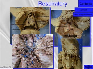 ContentsRespiratory
Answers
Back to system index
 