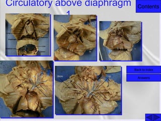 ContentsCirculatory above diaphragm
1
Back to index
Answers
 