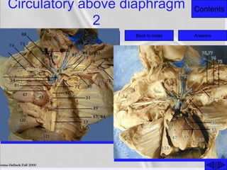 ContentsCirculatory above diaphragm
2
Back to index Answers
 
