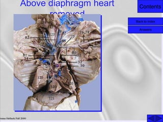 ContentsAbove diaphragm heart
removed
Back to index
Answers
 