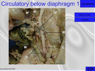 ContentsCirculatory below diaphragm 1
Back to index
Answers
 