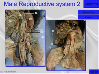 ContentsMale Reproductive system 2
Back to index
Answers
 