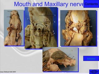ContentsMouth and Maxillary nerve
Answers
 