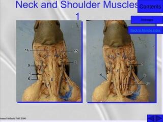 ContentsNeck and Shoulder Muscles
1
Back to Muscle index
Answers
 