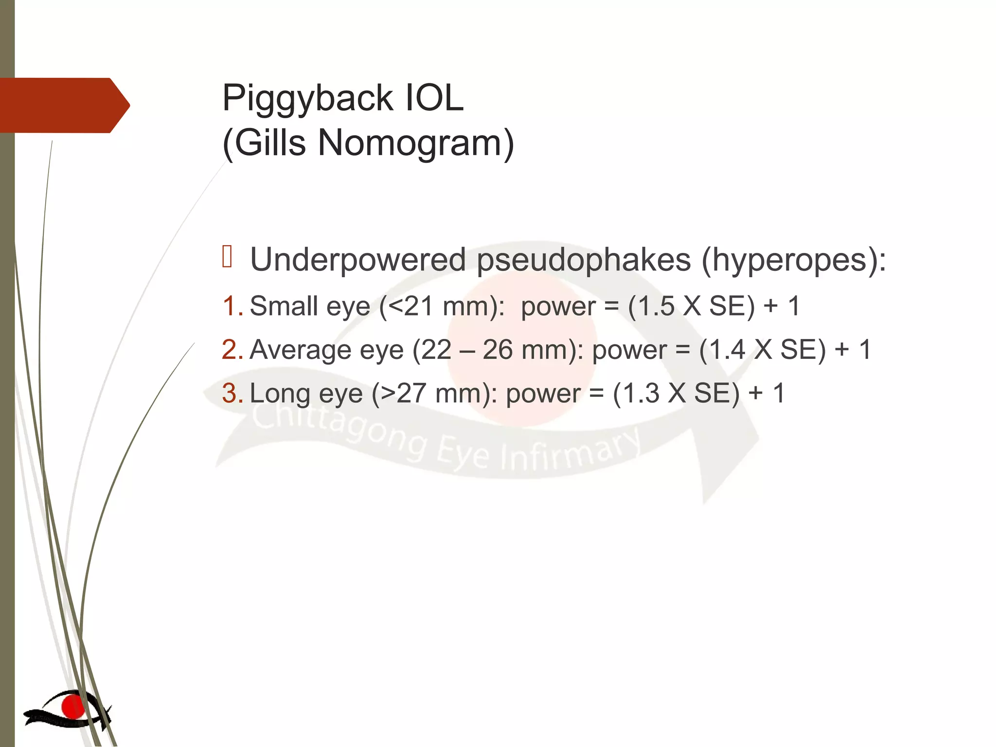 Piggyback IOL
(Gills Nomogram)
 Underpowered pseudophakes (hyperopes):
1. Small eye (<21 mm): power = (1.5 X SE) + 1
2. Average eye (22 – 26 mm): power = (1.4 X SE) + 1
3. Long eye (>27 mm): power = (1.3 X SE) + 1
 