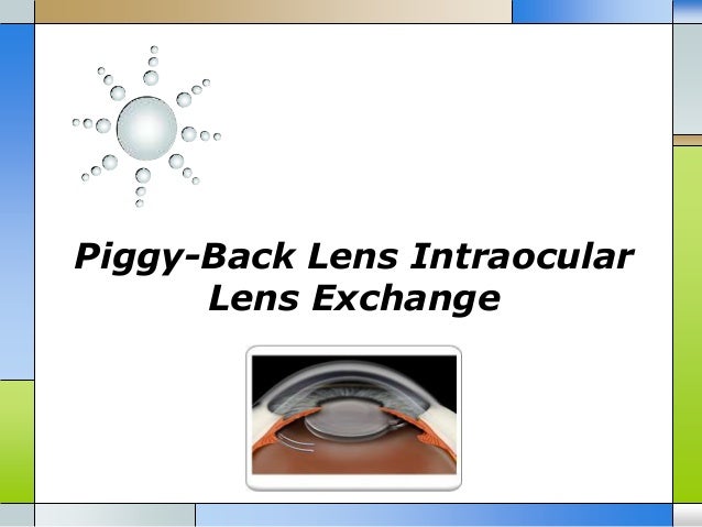 Piggy Back Lens Intraocular Lens Exchange Piggy Back Lens Intraocular Lens Exchange