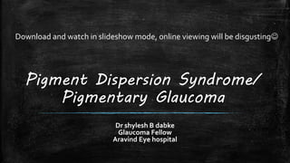 Pigment Dispersion Syndrome/
Pigmentary Glaucoma
Dr shylesh B dabke
Glaucoma Fellow
Aravind Eye hospital
Download and watch in slideshow mode, online viewing will be disgusting
 