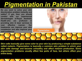 Do you want to solve your skin
discoloration problem instantly and
safely? If yes, then you should
contact with our experienced
dermatologist of Royal Aesthetic
Health who are proficient in
providing skin & laser services in
cost effective manner. Our
treatments can improve your skin
complexion and also improve your
self-confidence.
Pigmentation in PakistanPigmentation in Pakistan
Skin cells basically give some color to your skin by producing a simple substance
called melanin. Pigmentation is basically a common skin problem in which your
skin cells damage and become unhealthy and affect melanin production. Some
pigmentation problems usually affect few parts of face, but others affect your
entire body.
 