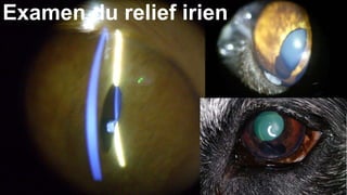 Examen du relief irien 
 