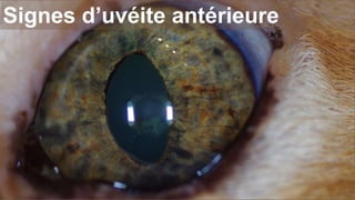 Signes d’uvéite antérieure 
 