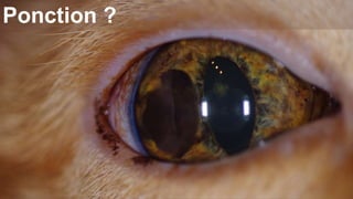 Ponction ? 
 