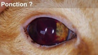 Ponction ? 
 