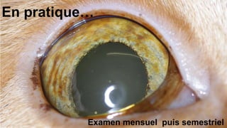 En pratique… 
Examen mensuel puis semestriel 
 