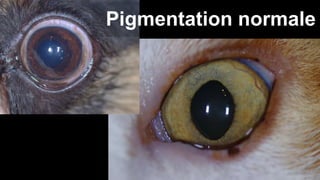 Pigmentation normale 
 