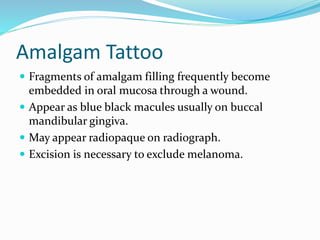 Amalgam Tattoo Just teeth Christchurch Dentist