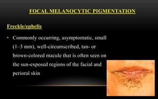 melanotic hyperpigmentation Multifocal oral melanoacanthoma and melanotic macula in a patient after  dental implant surgery main image 1