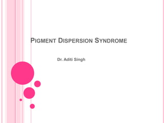 PIGMENT DISPERSION SYNDROME 
Dr. Aditi Singh 
 