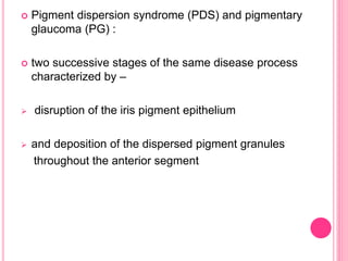  Pigment dispersion syndrome (PDS) and pigmentary 
glaucoma (PG) : 
 two successive stages of the same disease process 
characterized by – 
 disruption of the iris pigment epithelium 
 and deposition of the dispersed pigment granules 
throughout the anterior segment 
 