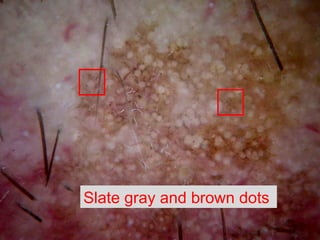 Slate gray and brown dots  