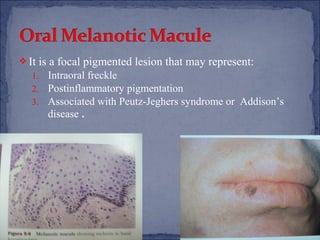 Pigmented lesion