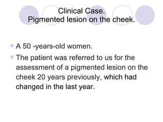 Clinical Case. Pigmented lesion on the cheek. A 50 -years-old women. The patient was referred   to us for the assessment of a  pigmented lesion on the cheek 20  years previously,  which had changed in the last year.   