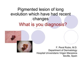 Pigmented lesion of long evolution which have had recent changes What is you diagnosis? F. Peral Rubio, M.D. Department of Dermatology Hospital Universitario Virgen Macarena Seville, Spain 