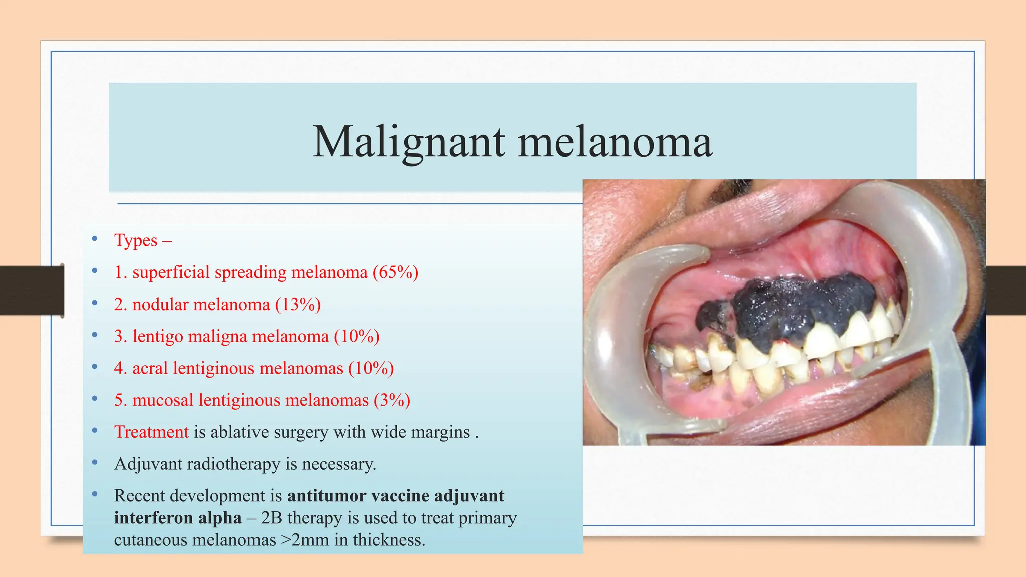 Pigmented lesion of oral mucosa.pptx- DR PRIYANKA