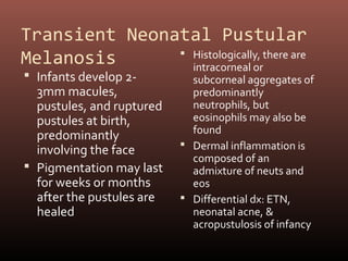 Transient Neonatal Pustular
Melanosis       Histologically, there are
                 intracorneal or
 Infants develop 2-         subcorneal aggregates of
  3mm macules,               predominantly
  pustules, and ruptured     neutrophils, but
  pustules at birth,         eosinophils may also be
                             found
  predominantly
                            Dermal inflammation is
  involving the face
                             composed of an
 Pigmentation may last      admixture of neuts and
  for weeks or months        eos
  after the pustules are    Differential dx: ETN,
  healed                     neonatal acne, &
                             acropustulosis of infancy
 