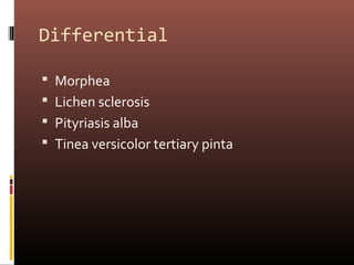 Differential

 Morphea
 Lichen sclerosis
 Pityriasis alba
 Tinea versicolor tertiary pinta
 