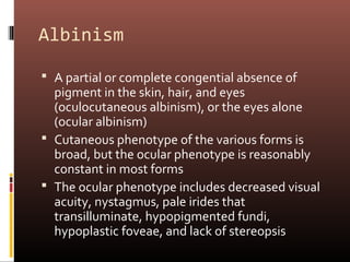 Albinism

 A partial or complete congential absence of
  pigment in the skin, hair, and eyes
  (oculocutaneous albinism), or the eyes alone
  (ocular albinism)
 Cutaneous phenotype of the various forms is
  broad, but the ocular phenotype is reasonably
  constant in most forms
 The ocular phenotype includes decreased visual
  acuity, nystagmus, pale irides that
  transilluminate, hypopigmented fundi,
  hypoplastic foveae, and lack of stereopsis
 