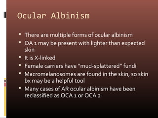 Ocular Albinism

 There are multiple forms of ocular albinism
 OA 1 may be present with lighter than expected
    skin
   It is X-linked
   Female carriers have “mud-splattered” fundi
   Macromelanosomes are found in the skin, so skin
    bx may be a helpful tool
   Many cases of AR ocular albinism have been
    reclassified as OCA 1 or OCA 2
 