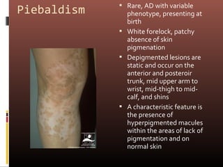  Rare, AD with variable
Piebaldism     phenotype, presenting at
               birth
              White forelock, patchy
               absence of skin
               pigmenation
              Depigmented lesions are
               static and occur on the
               anterior and posteroir
               trunk, mid upper arm to
               wrist, mid-thigh to mid-
               calf, and shins
              A characteristic feature is
               the presence of
               hyperpigmented macules
               within the areas of lack of
               pigmentation and on
               normal skin
 