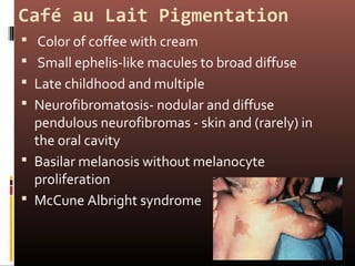 oral melanotic macule slideshare Pigmented lesions Oral Melanotic Macule - MEDizzy