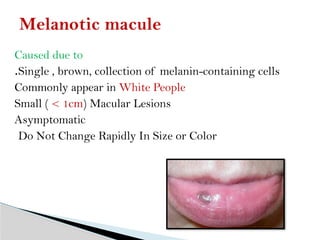 Pigmented lesions of oral cavity #4.pptx Pigmented lesions of oral cavity #4.pptx