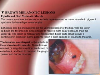 Pigmented lesions of oral mucosa