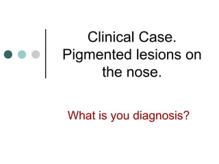 Clinical Case. Pigmented lesions on the nose. What is you diagnosis? 