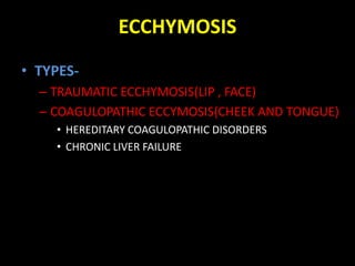 Pigmented lesions of oral cavity | PPTX