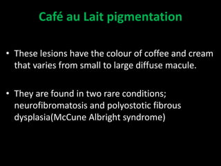 Pigmented lesions of oral cavity | PPTX