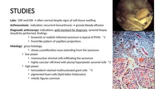 Pvns Rash Pigmented Villonodular Synovitis (PVNS).pptx